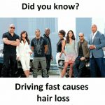 Driving Fast Causes Hair Loss Funny Meme